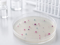 Chromogene Medien